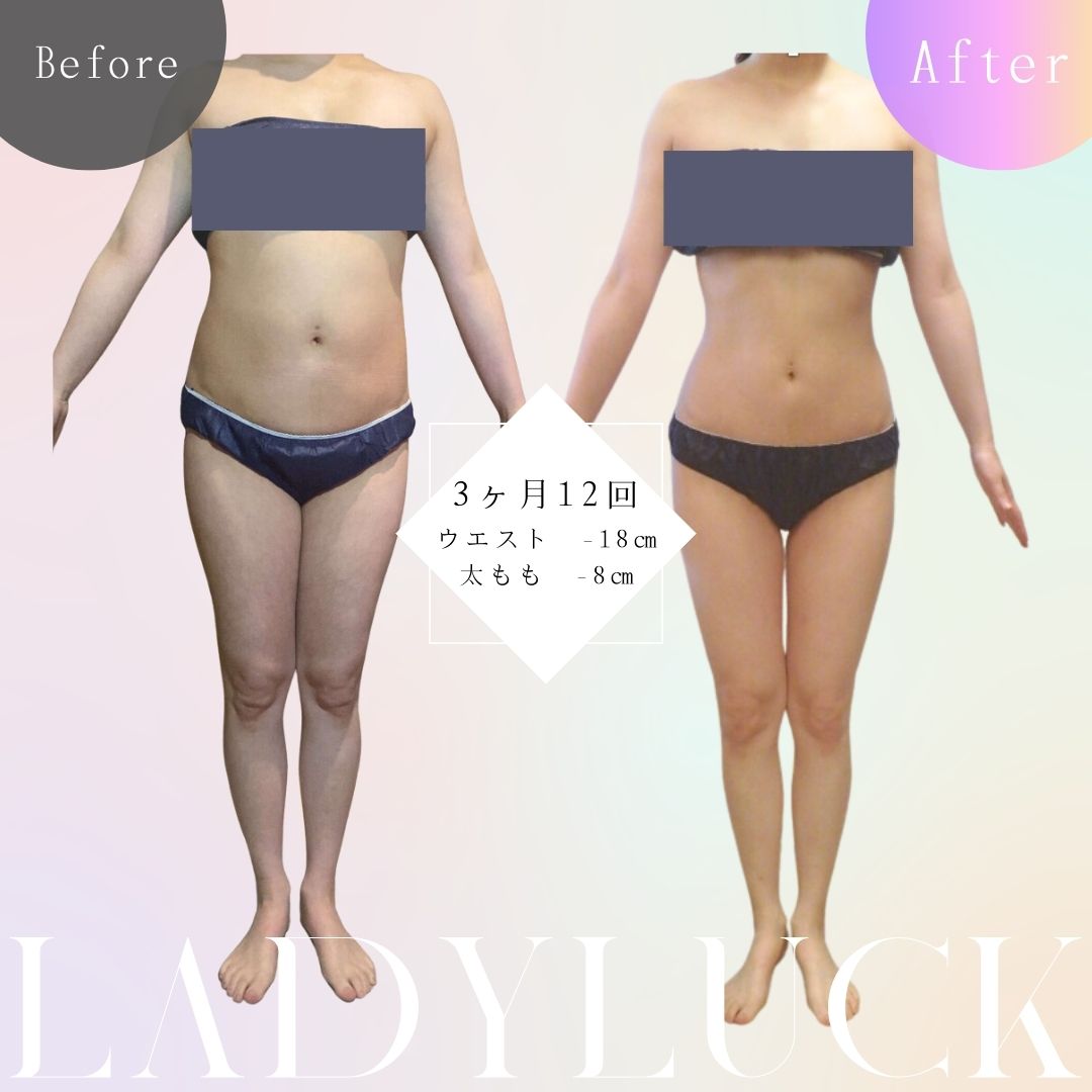 痩身王道キャビテーション！！/Ultimate Slimming: Cavitation!